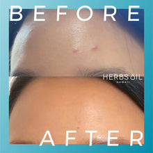 Load image into Gallery viewer, Herbs' Oil Clarifying Glow Booster Jelly Cleanser 177ml