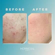 Load image into Gallery viewer, Herbs' Oil Clarifying Glow Booster Jelly Cleanser 177ml