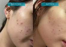 Load image into Gallery viewer, Herbs' Oil Hydrating Enzyme Fruit Mask 60ml