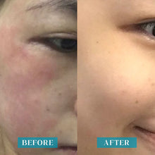 Load image into Gallery viewer, Herbs' Oil SOS Skin Booster Barrier Cream 60ml